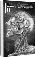 Battle Angel Alita – Mars Chronicle 11